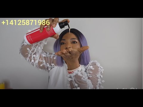 Best cream for sunburn hyperpigmentation damaged skin with green veins dark knuckles